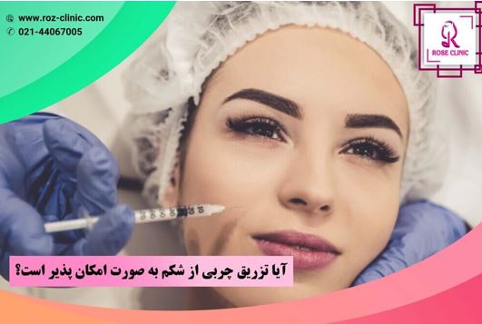 تزریق-چربی-۲