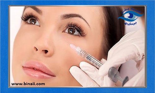 از بین بردن سیاهی و گودی زیر چشم با تزریق بوتاکس