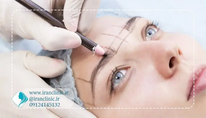 کاشت-ابرو۲