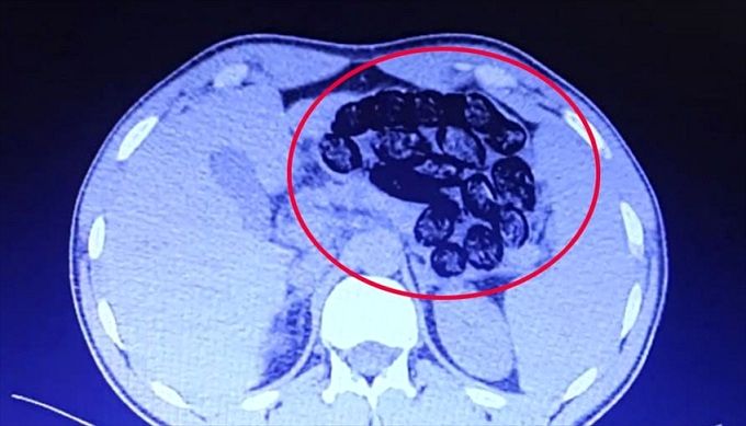 پلیس ترکیه دو ایرانی را دستگیر کرد+ عکس